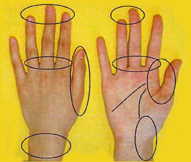 指先や指の付け根、手首を丸で囲った、左手の甲と右手の平の写真