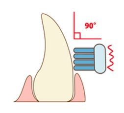 歯ブラシの当て方のイラスト